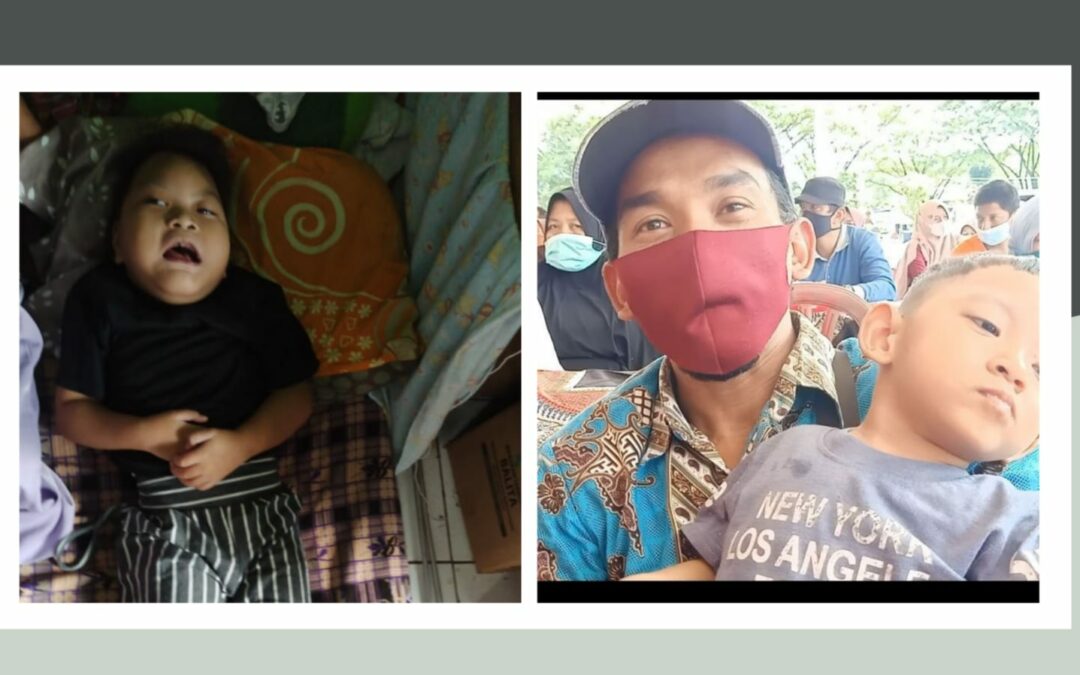 Inara, Bocah penderita PC dapat bantuan pemkab